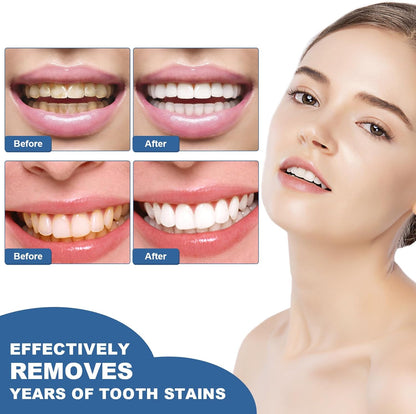 Transform Your Smile with Our Teeth Whitening Essence Pen Set - 2 Pieces for Effortless Stain Removal and Fresh Breath